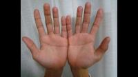 手抖会因为情绪变化而受到影响吗？